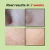 SUNGBOON EDITOR [SUNGBOON EDITOR]Green Tomato Pore Lifting Ampoule+ 30ml