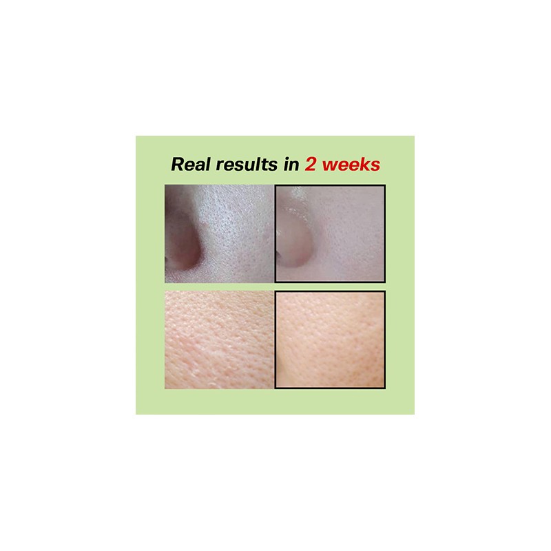 SUNGBOON EDITOR [SUNGBOON EDITOR]Green Tomato Pore Lifting Ampoule+ 30ml