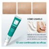 Crema Para Eliminar Cicatrices Para Reparar Cicatrices 1pc
