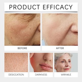 Suero reafirmante en barra con péptidos de colágeno, roll-on de retinol, reafirmante en barra para rostro y cuello, reafirmante y tensor para el cuello, reafirmante antiarrugas para el cuello (3)