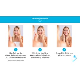 TheraCare Skin Control Gel I Acne Cream I Pimple Cream I Anti-Acne I Blood Stiller I for Use for Pimples, Acne and Impurities