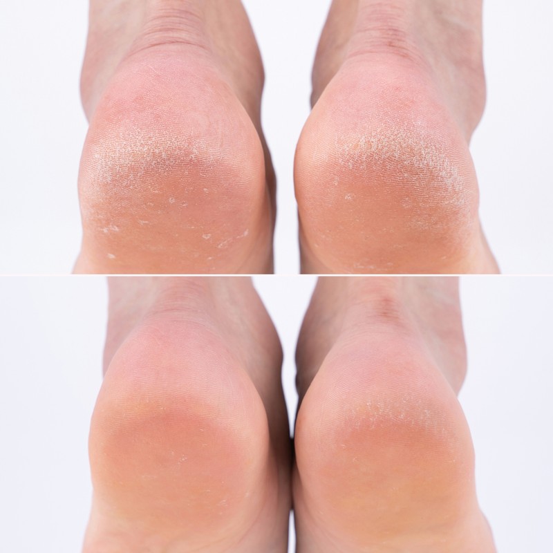3 foot pack socks included / 발팩 양말 3개입