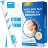 Plasma Pen Fibroblast Pen 9 intensidades Inalambrico
