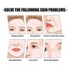 Parches Antiarrugas Rostro Frente 192 Invisibles Lifting Facial Reducir Arrugas