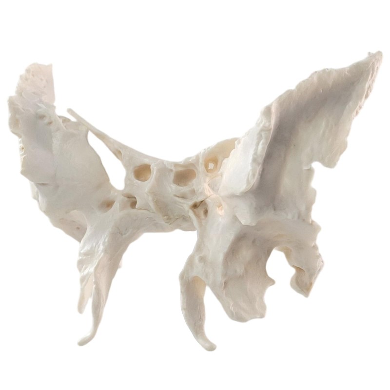 Benilev Human Sphenoid Anatomical Model, Life Size, Presenting Complete Cracks,