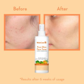 WishCare Pure Glow Facial Toner - 5% Fruit AHA, Hyaluronic Acid, Niacinamide and Oranges - For Radiant and Pore Minimising Effect - 200ml (PGFT200)