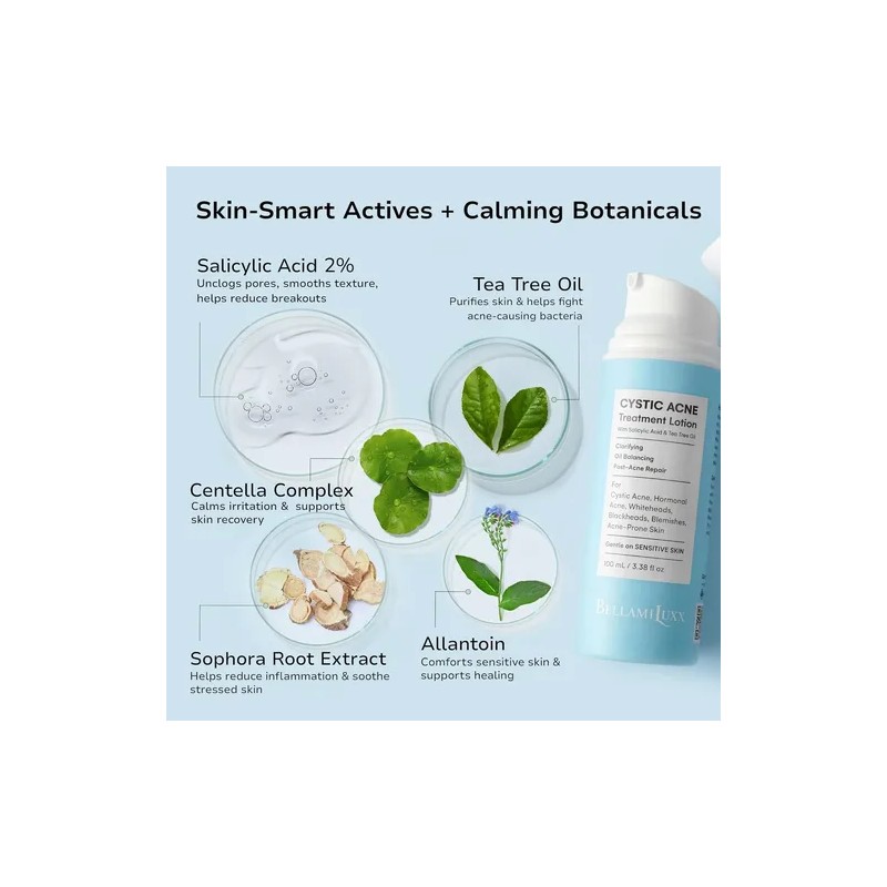 Tratamiento Bellamiluxx Para El Acné Quístico Facial: Crema