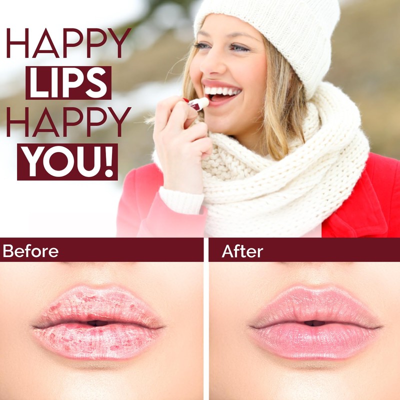 WBM Lip Balm, Formulated with Cherry & Shea Butter, Moisturization