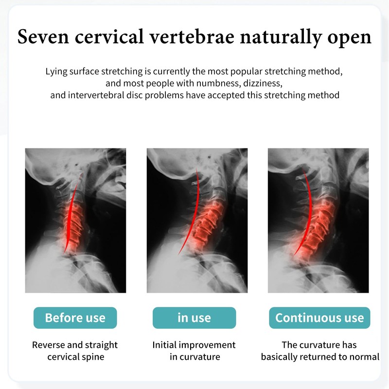 Neck and Shoulder Relaxer, Portable Cervical Neck Stretcher, Neck Posture