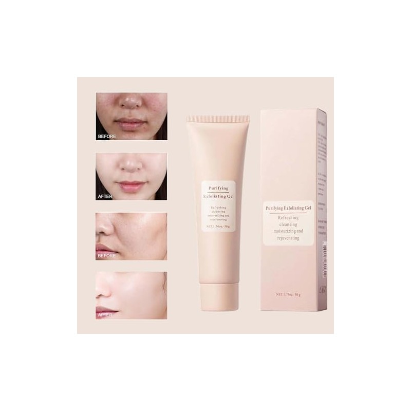Purifying Exfoliating Gel,Exfoliating Gel for Face, Purifying Cream,Exfoliating Face Scrub,Exfoliating