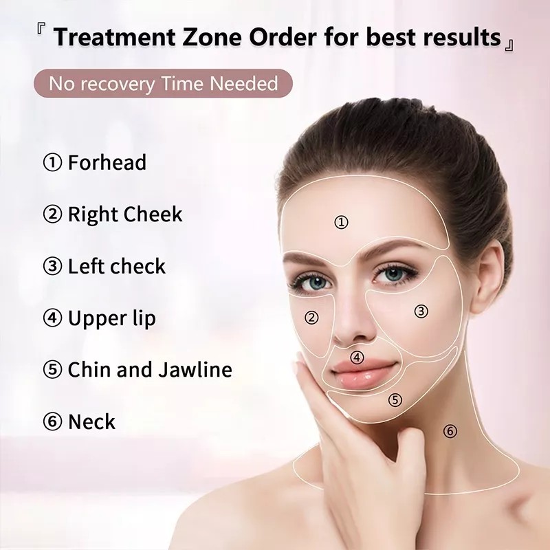 Mini Hifu Hifu Mini 2th Generation Lifting Facial Radiofrecuencia Sms