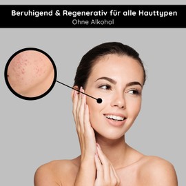 RAU Cosmetics Tonic alcohol-free 200 ml - Gesichtswasser mit Brennnessel-Extrakt - Gesichtsreinigung geeignet für Unreine Haut, Fettige Haut, Reife Haut - Toner mit Karamell & Milchsäure