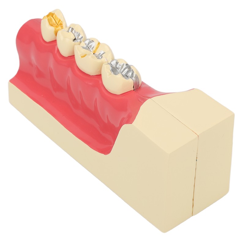 Right Lower Posterior Tooth Model 2X Magnification Detachable Resin Tooth