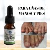 Fungicida Arbol Del Te Para Uñas Con Hongos Y Pie