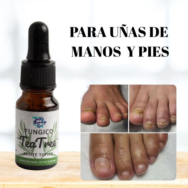 Fungicida Arbol Del Te Para Uñas Con Hongos Y Pie