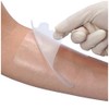 Alcare 16386 Multi-Fix Breathable and Waterproof Surgical Film, 1.9 x
