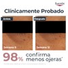 Eucerin Anti-Pigment Crema Contorno de Ojos 15ml - Suaviza las