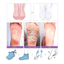 Tonymoly Changing U Magic Foot Peeling Shoes