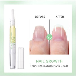 2PCS Radiant Nail Growth Oil,Cuticle Oil for Nail,Radiant Nail Growth Oil Pen,Nail Growth Oil,Rejuvenation Nail Growth Oil,Nail Strengthener,Nail Nutrition Pen for Moisturize Dry Nails & Cuticles Care