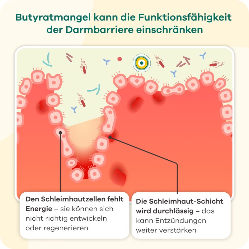 Butyzole - Diet Management for Irritable Bowel Dietra, Diverticula &