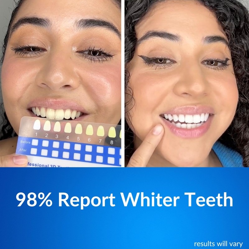 Polar MD Teeth Whitening Kit, Professional Teeth Whitener Gel Pens,