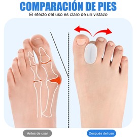 4 Piezas Separadores De Dedos De Gel, Correctores de Juanetes, Separador de Esparcidor de Dedos de Gel de Silicona Separador Espaciador para Aliviar el Dolor de Juanete Uso Diario para Mujere y Hombre