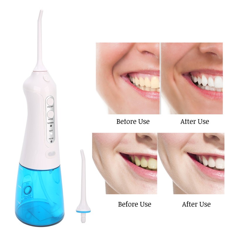 Rechargeable Electric Oral Irrigator Portable Water Flosser Teeth Cleaner Oral