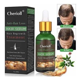 El Crecimiento Del Cabello Suero, Pérdida De Cabello Y AdeLG