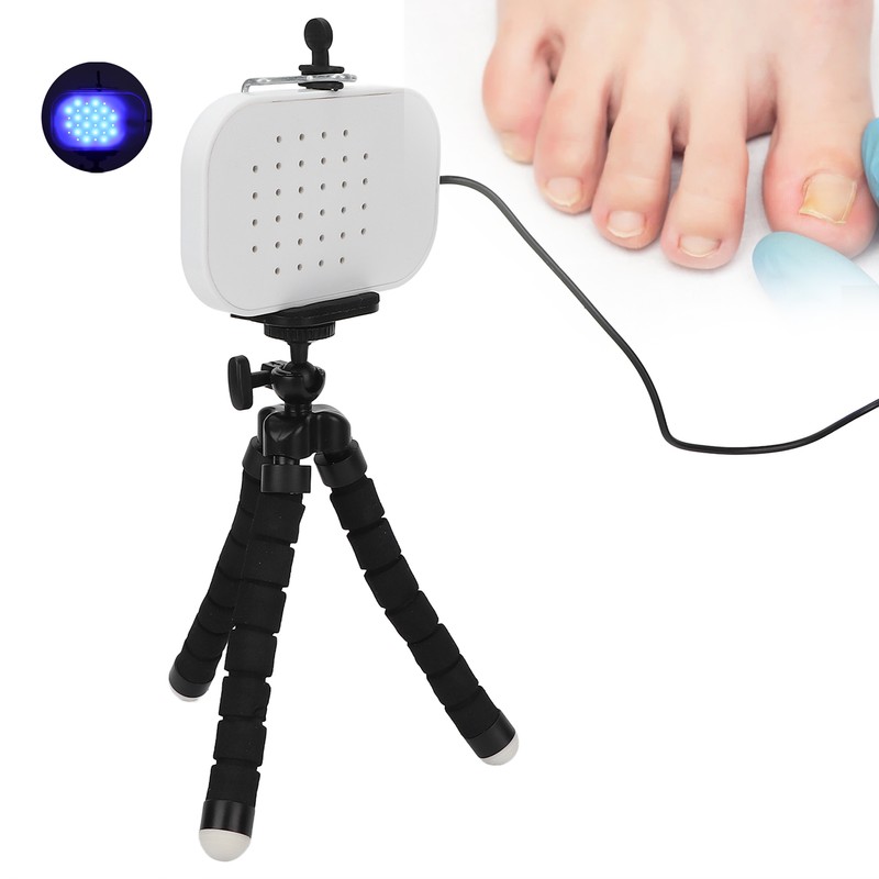 Leuconychia Remover Treatment Device Safe Quick Painless Portable Toe Nails