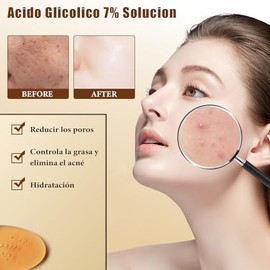 Ácido Glicólico 7% Solución 240ML, Ácido Glicólico 7% Tonifica, Exfolia, Reduce las Marcas del Acné y los Granitos, Rejuvenece la Piel, Un Tónico Facial que lumina tu Cutis.