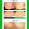 Dievu Dieevu Tricasso Kit [Ampoule Gel Casal Cream] Moisture glow