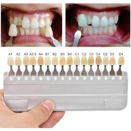 APLICACIÓN: Utilice su guía de colores dentales favorita después de la preparación de la corona o del procedimiento de blanqueamiento. Tabla de dientes adecuada tanto para dentistas profesiona