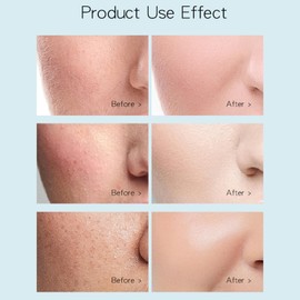 Apply 10Stück Gelee-Gesichtsmaskenpulver,Feuchtigkeitsspendende Gesichtsmaske Peel Off Mehrere Aromen Macaroon Maske Pulver Für Gesichtspflege,Gesichtsmaske Peel-Off Mit Zubehör Für Die Gesichtspflege