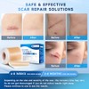 Rvlaim Silicone Scar Sheets for Effective Scar Treatment