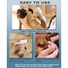 Pets Ear Canal Mite Removal-VISOOP Portable Dogs/Cats Ear Care Device,