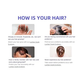 lushair Wireless Hair Analyzer, Hair Follicle Tester, Scalp Microscope, 16-Function Detection, AI Intelligent Analysis Provides Care Plan