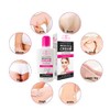 Crema Suave Aclaradora Aichun Beauty Cara Cuerpo Aclara Rodillas Codos