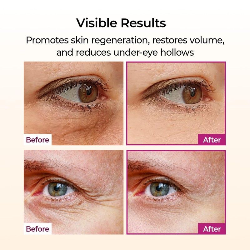 Dr.Melaxin Calcium Multi Balm Stick, Collagen & Elastin Wrinkle Stick,