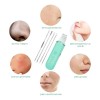 Limpiador Facial Peeling Ultrasónico Portatil Skin Scrubber