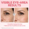 Under Eye Roller Serum for Puffiness and Dark Circles, 3