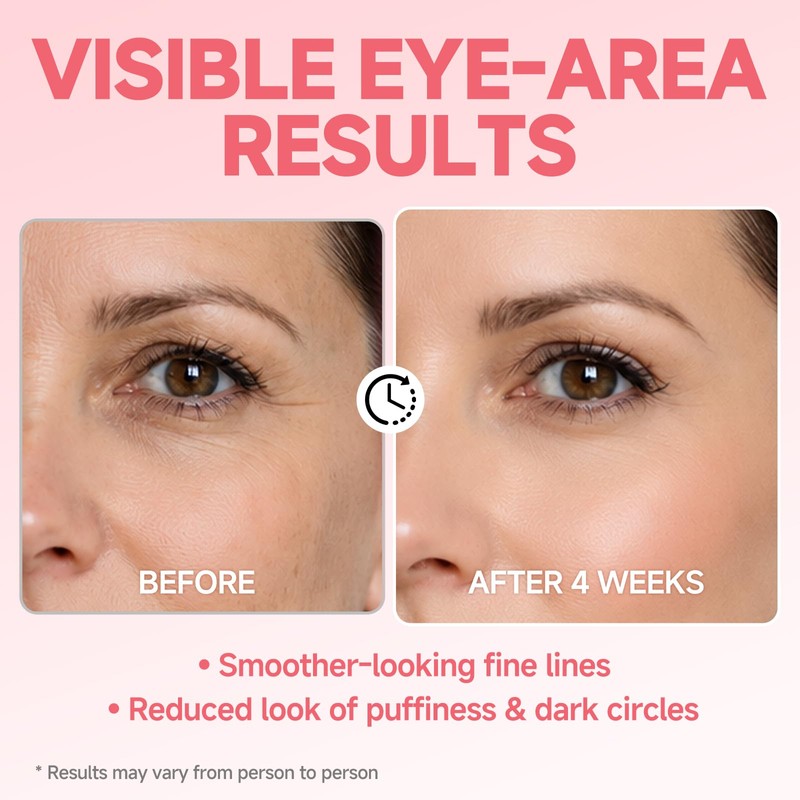 Under Eye Roller Serum for Puffiness and Dark Circles, 3