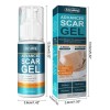 Crema For Eliminar Cicatrices Gel For Cicatrices De Acné &lx