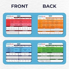 EKG Buddy's - Juego de 5 tarjetas de interpretación de ECG - Hoja de trucos de doble cara para enfermera, hoja de trucos de ritmo, tiras de telemetría de EKG para referencia médica cardíaca y