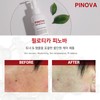 Philotica Pinova 200ml ampoule toner exfoliation removal Philotica Pinova 200ml