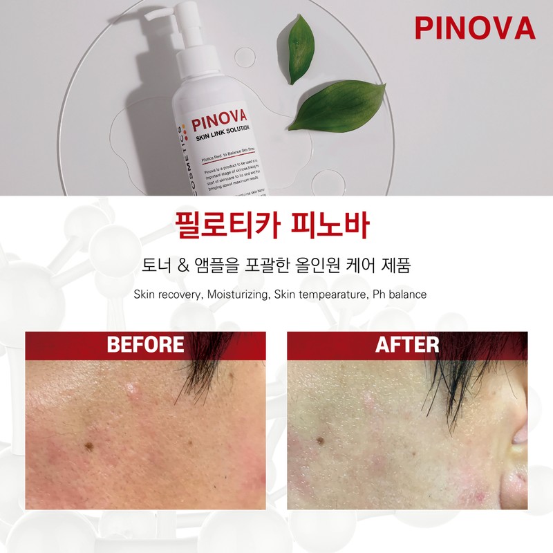 Philotica Pinova 200ml ampoule toner exfoliation removal Philotica Pinova 200ml