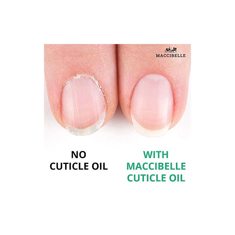 Cuticle Oil 15ml Tea Tree Lavender Heals Dry Cracked Cuticles