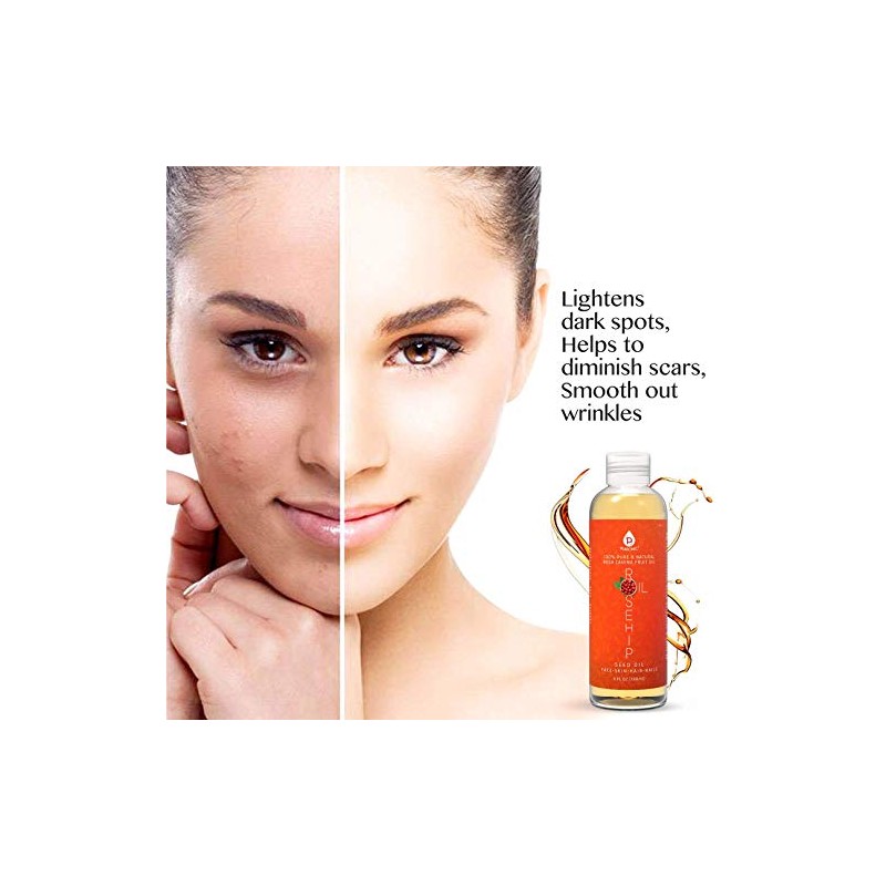 Pursonic Rosehip Oil for Face, Nails, Hair and Skin, 6