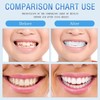 2 Pairs Beginner-Friendly Smile Tuning Kit, Tool-Free Shaping, Reusable Universal