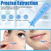 Yeenao Pimple Stickers