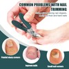 3pcs Ingrown Toenail Clippers Set, Professional Beveled Eagle Beak Nail